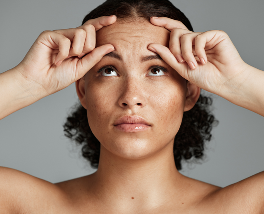 Acné, problèmes de peau... : comment les traiter naturellement ?