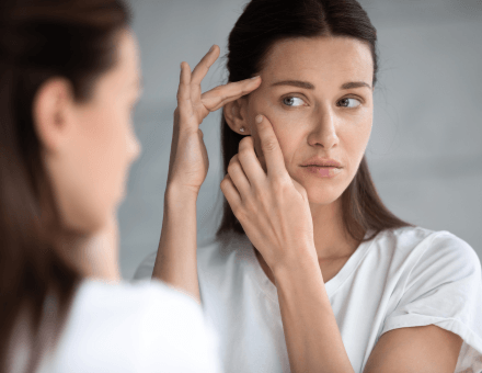 Comment soigner son acné naturellement ? - Forté Pharma